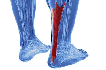Achilles Tendonitis Treatment in the Midtown Manhattan, NY: Grand Central Park, Bryant Park, Rockefeller Center, Greenwich village, Chelsea, Gramercy Park, Peter Cooper Village, Hell's Kitchen, Lincoln Square, Manhattan Valley, Lenox Hill, Upper East Side,  Yorkville, Carnegie Hill, Hudson Square, Noho, Soho, Bowery areas