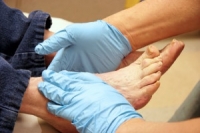 The Importance of Seeing a Podiatrist if You Have Diabetes